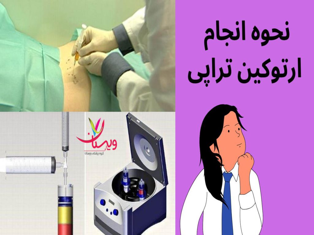 درد مفاصل نحوه انجام ارتوکین تراپی