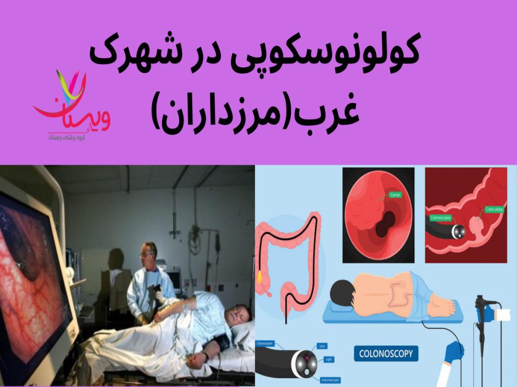 عمل کولونوسکوپی تحت بیحسی کولونوسکوپی در شهرک غرب(مرزداران)