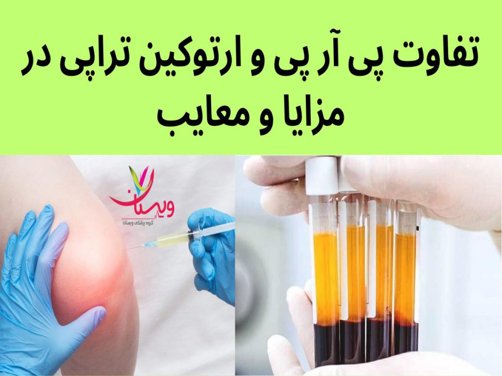 کاهش درد مزمن مفاصل تفاوت پی آر پی و ارتوکین تراپی در مزایا و معایب