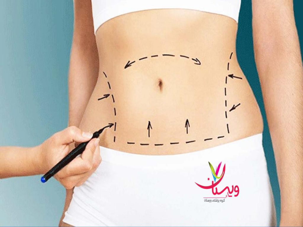 تحریک متابولیسم نخ انداختن ران ها برای لاغری