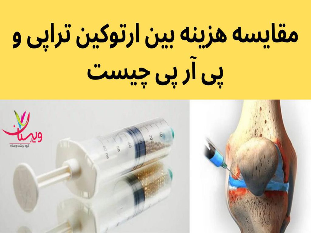 هزینه پی آر پی مقایسه هزینه بین ارتوکین تراپی و پی آر پی چیست