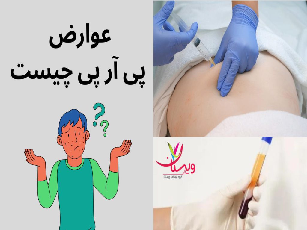 تزریق پیآرپی عوارض پی آر پی چیست