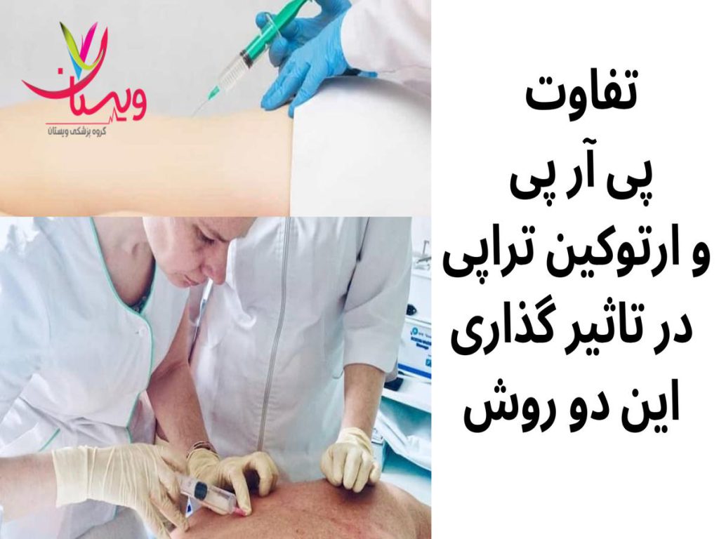 درمان التهاب مزمن تفاوت پی آر پی و ارتوکین تراپی در تاثیر گذاری این دو روش