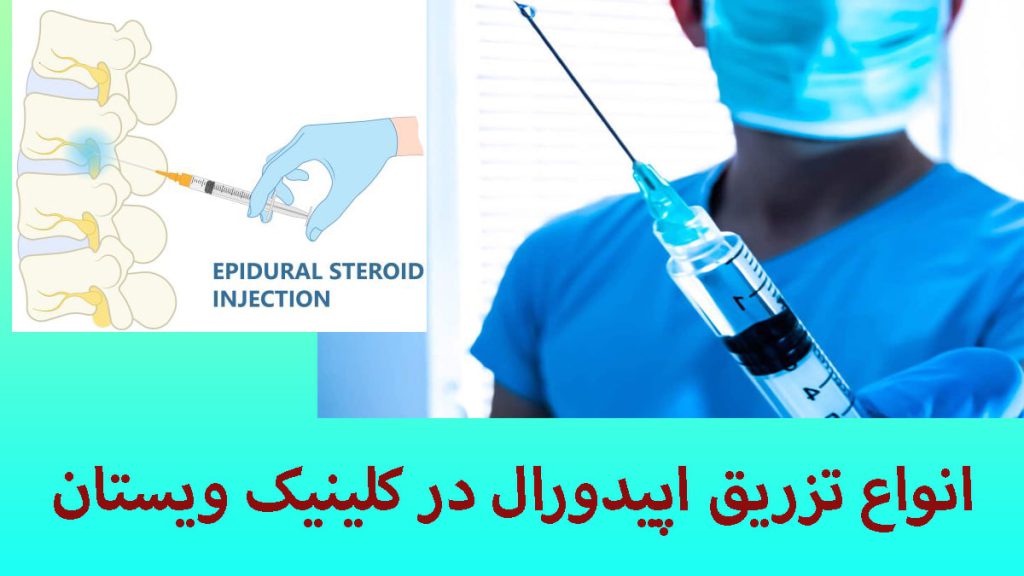 انواع تزریق اپیدورال کمر دو تصویر از یک پزشک در حالی که یک سرنگ برای تزریق اپیدورال در دست درد