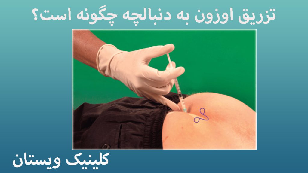 تزریق اوزون به دنبالچه یک شخص در حال تزریق اوزون به دنبالچه