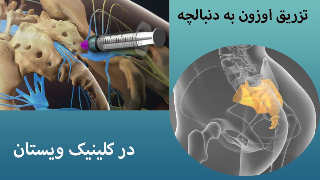 دو تصویر از دنبالچه و تزریق اوزون