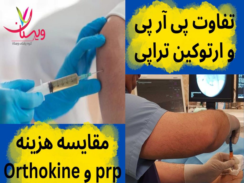 پی آر پی و ارتوکین تراپی تفاوت پی آر پی و ارتوکین تراپی