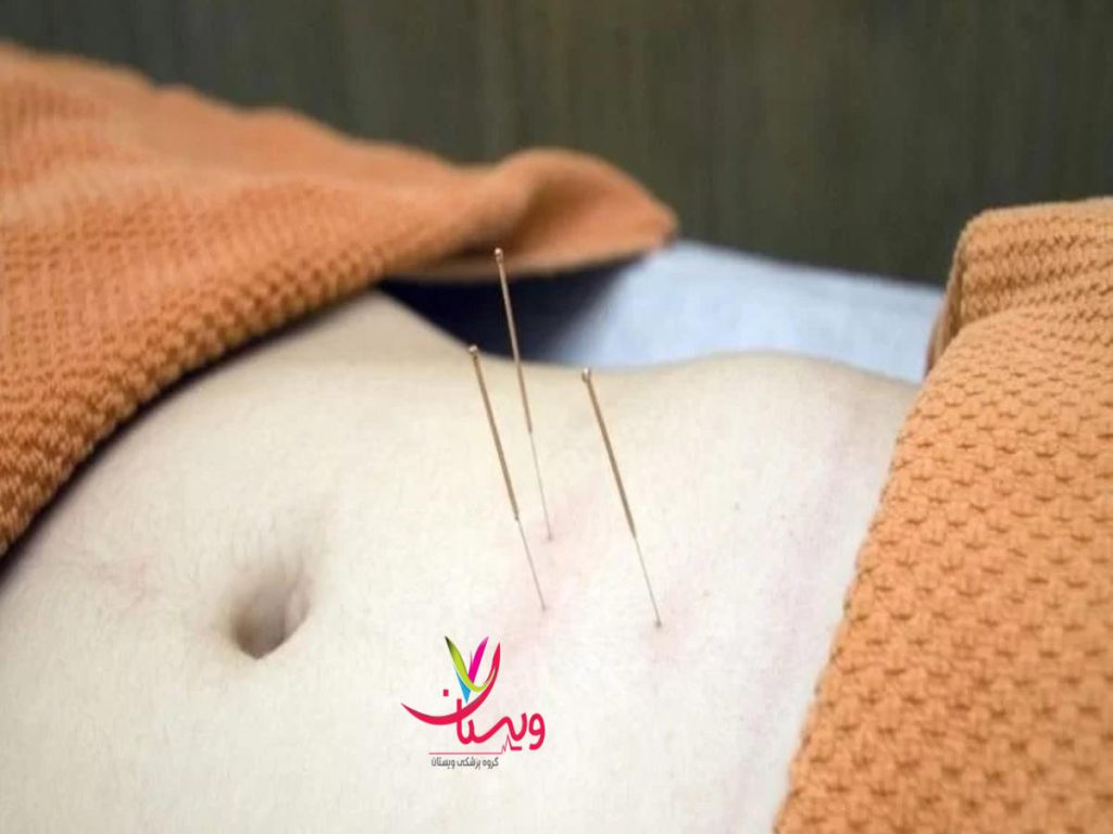عوارض امبدینگ چیست عوارض امبدینگ شکم