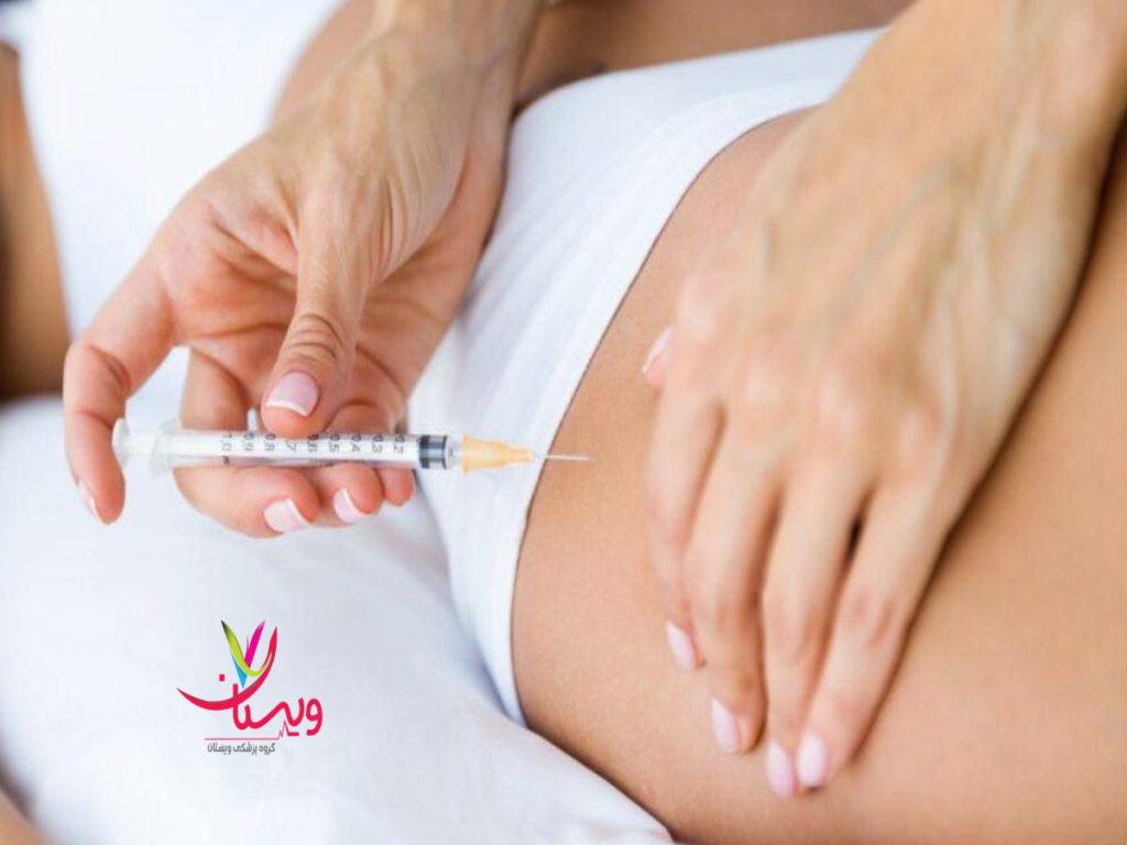 امبدینگ لاغری عوارض امبدینگ لاغری چیست