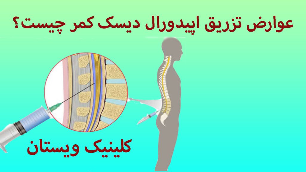 عوارض تزریق اپیدورال تزریق به مهره های کمر شخص به صورت زوم شده نشان داده می شود