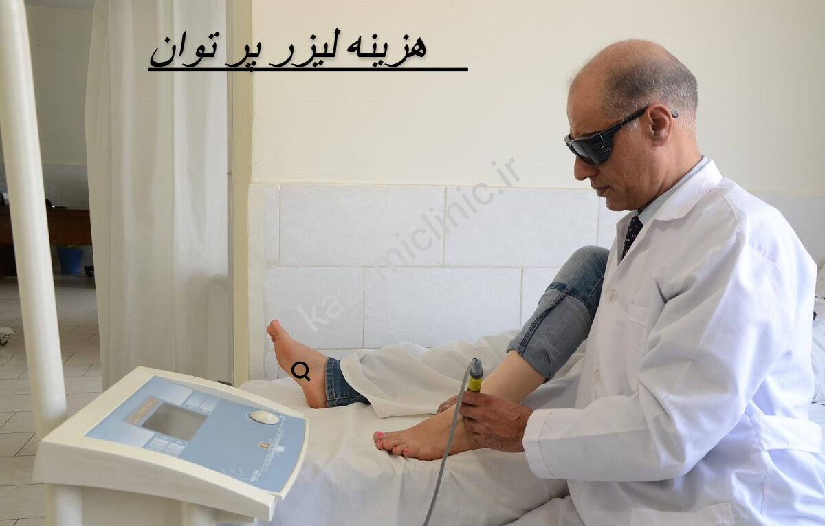 لیزر پرتوان