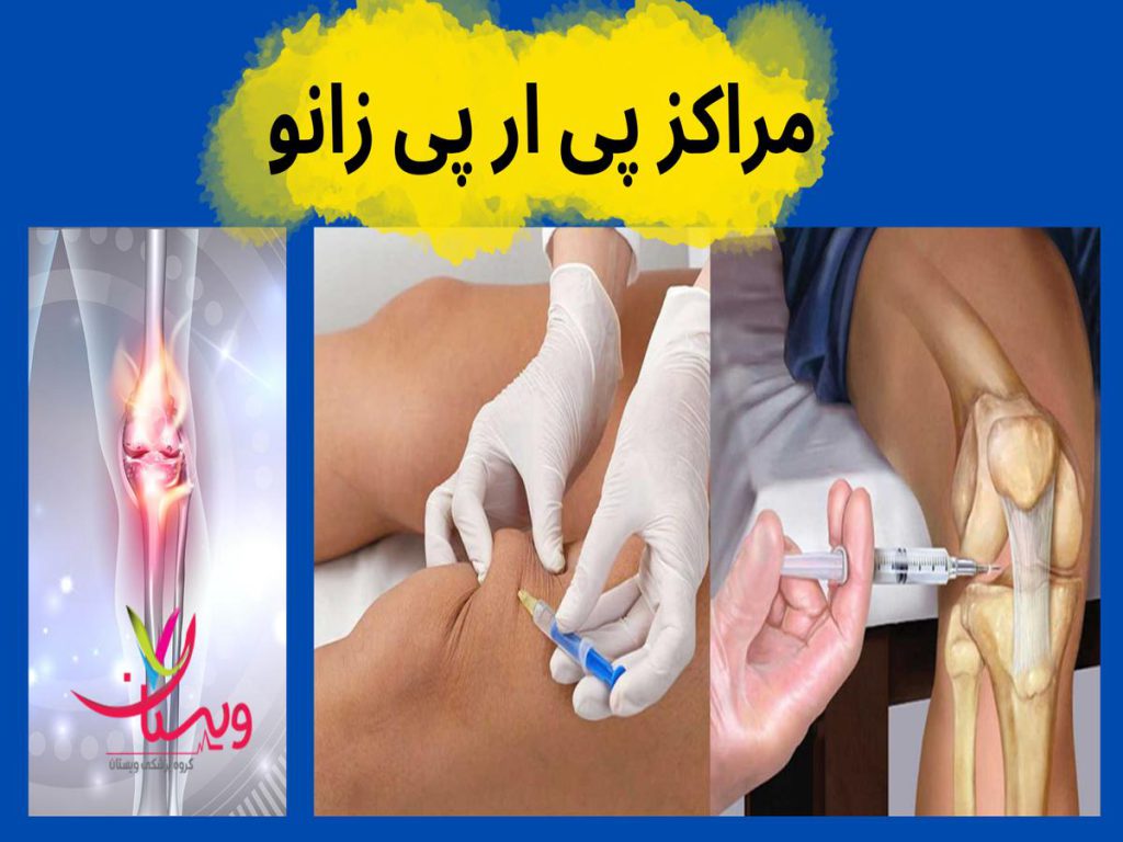 مراکز پی آر پی مراکز پی ار پی زانو (prpزانو)