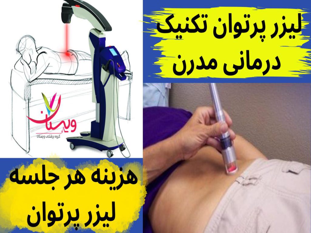 هزینه هر جلسه لیزر پرتوان