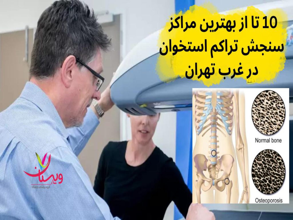 تراکمسنجی استخوان بهترین مراکز سنجش تراکم استخوان