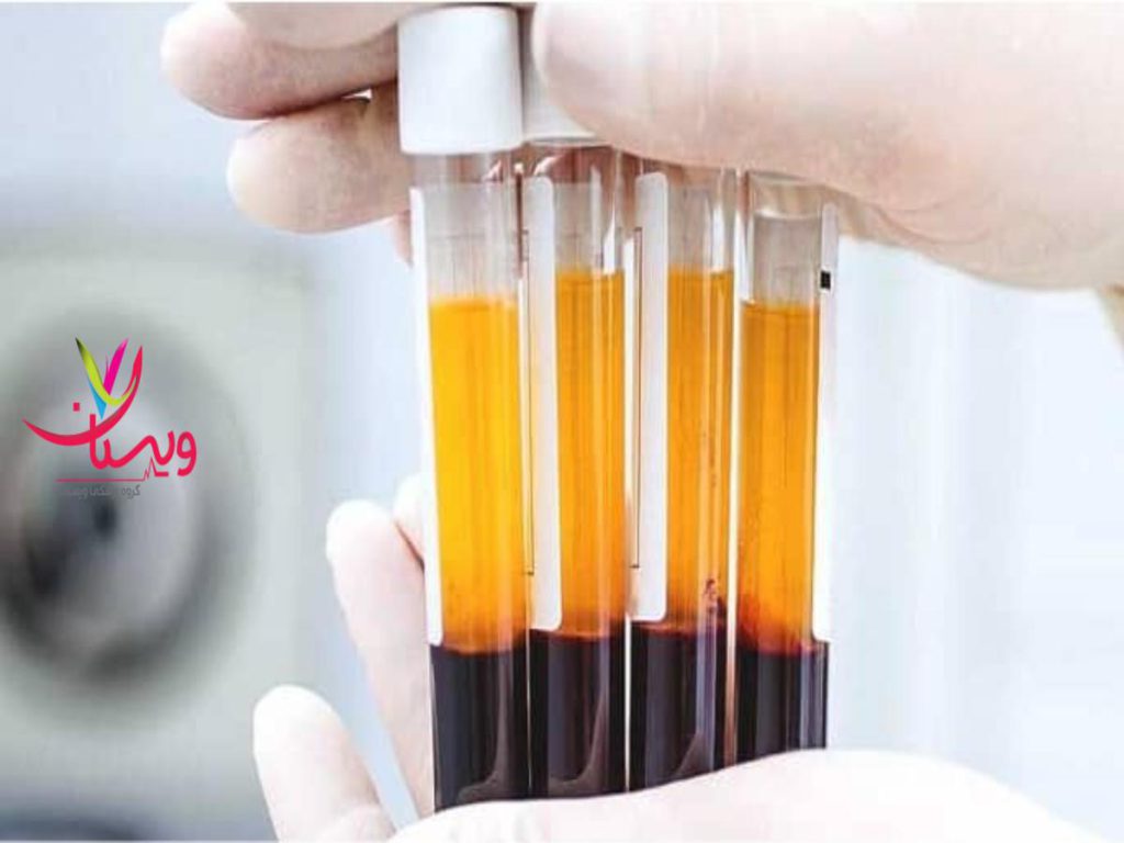 کلینیک ویستان بهترین مرکز پی آر پی در تهران