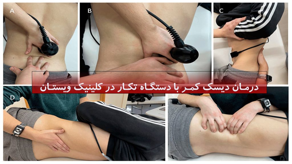 درمان دیسک کمر ب 5 تصویر از تکارتراپی کمر در کنار یکدیگر