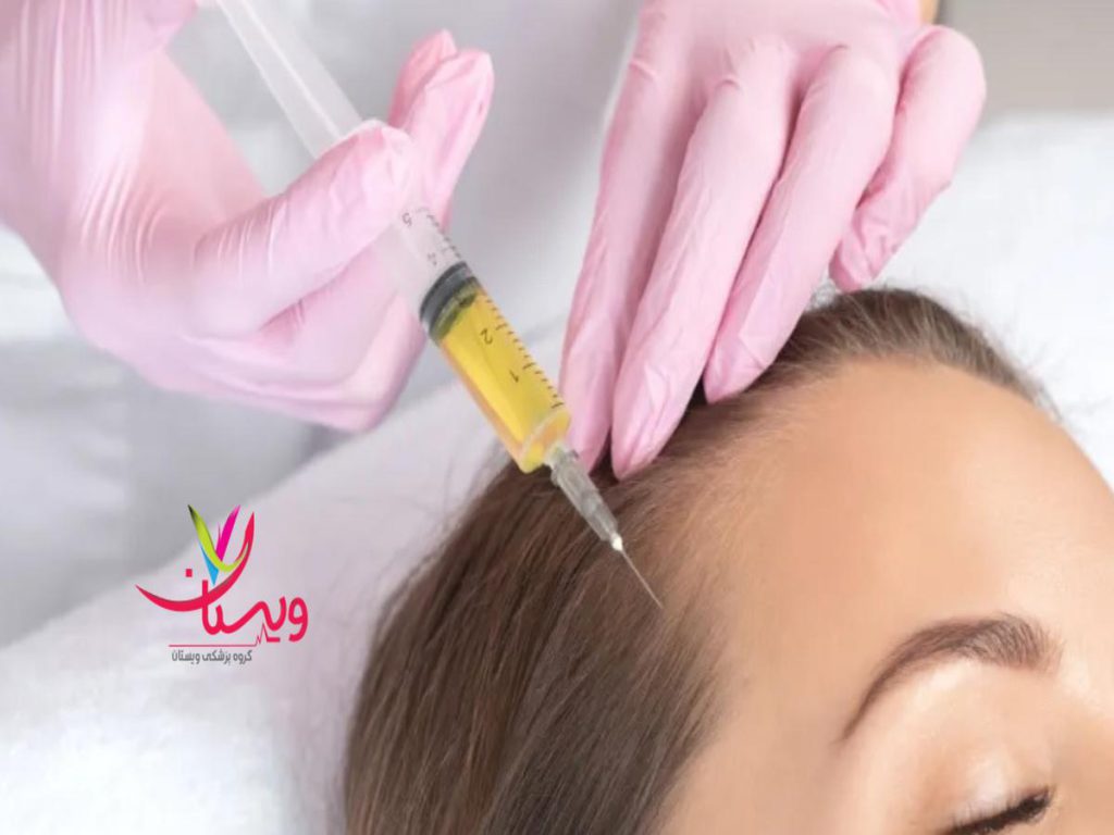 پلاسما غنی از پلاکت كيا از پي ار پي جواب گرفتن