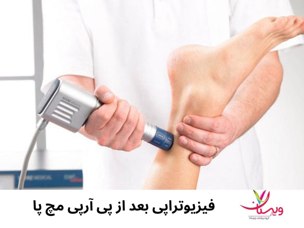 مراقبت های بعد از پی آر پی مچ پا