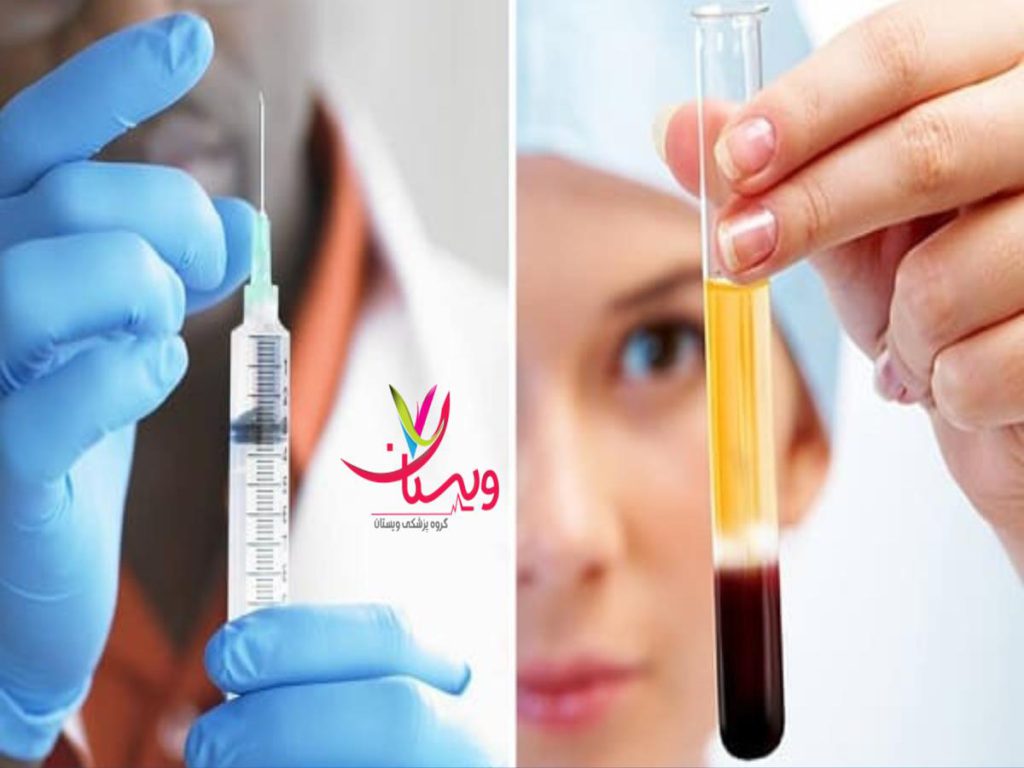 چند جلسه درمان PRP نظرات مردم در مورد پی ار پی