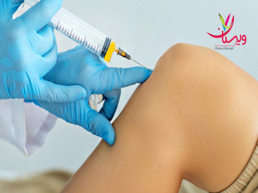 درمان PRP نظرات مردم در مورد پی ار پی زانو