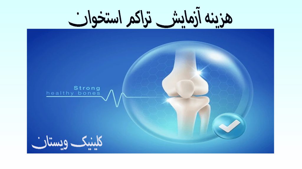 هزینه آزمایش تراکم استخوان تصویری دیجیتالی از استخوان