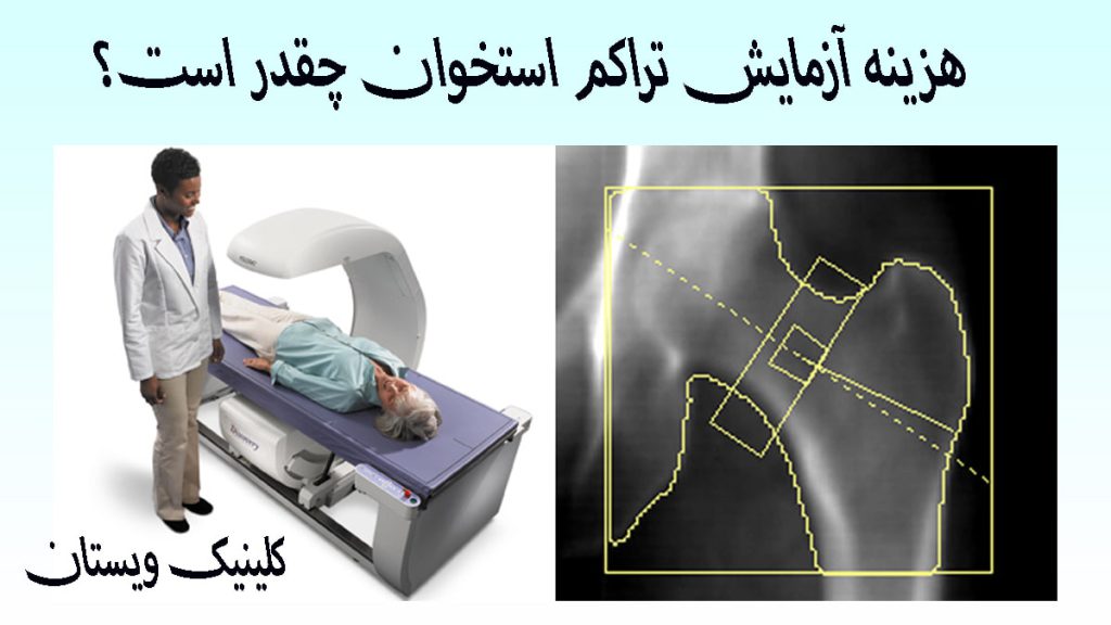 هزینه آزمایش تراکم استخوان دو تصویر در کنارر هم از یک بیمار در حال انجام آزمایش تراکم استخوان و یک عکس از نتیجه آزمایش
