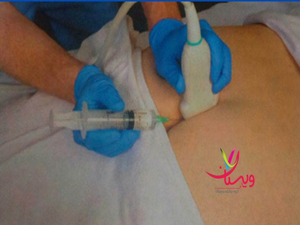 برای درمان درد دنبالچه به چه دکتری مراجعه کنیم