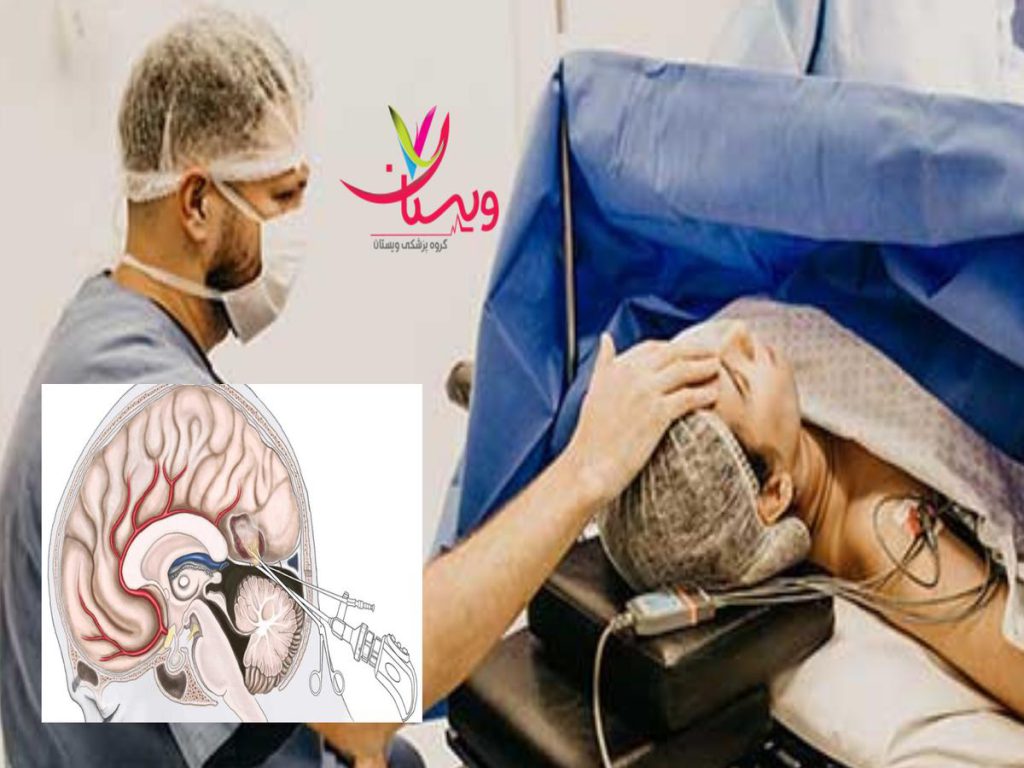 مغز و اعصاب بهترین فوق تخصص مغز و اعصاب بزرگسالان در تهران رتبه برتر