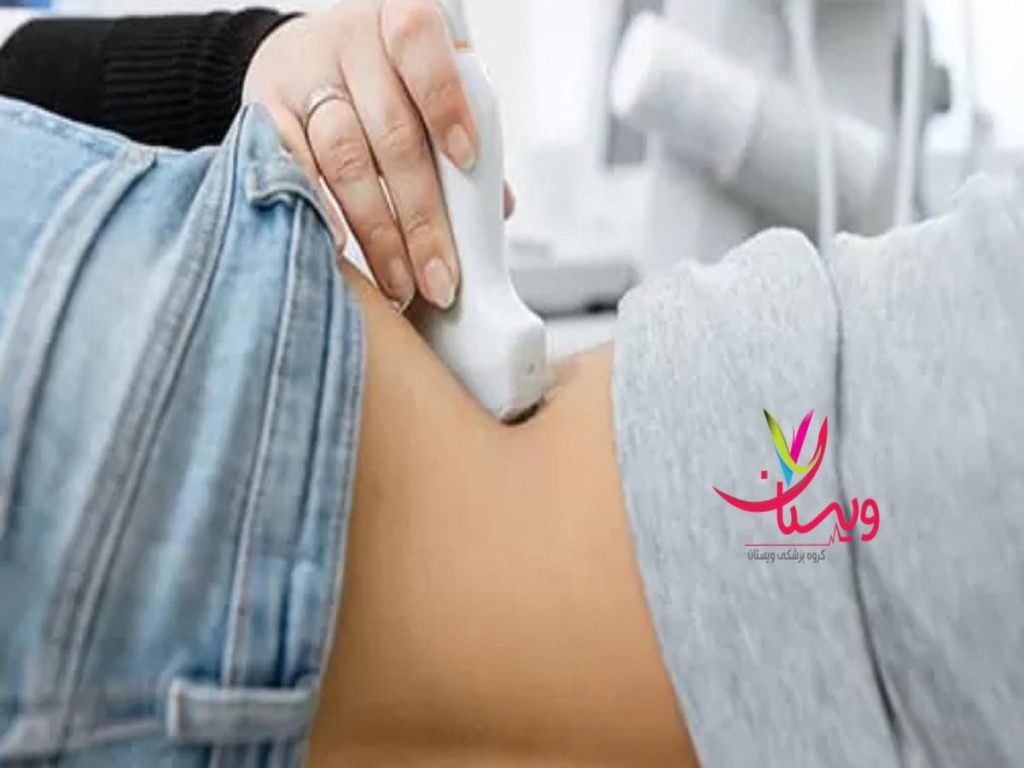 سونوگرافی شکم و لگن بهترین مرکز سونوگرافی شکم و لگن در تهران