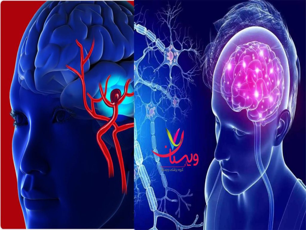 متخصص صرع و بیماریهای مغزی بهترین پروفسور مغز و اعصاب در تهران