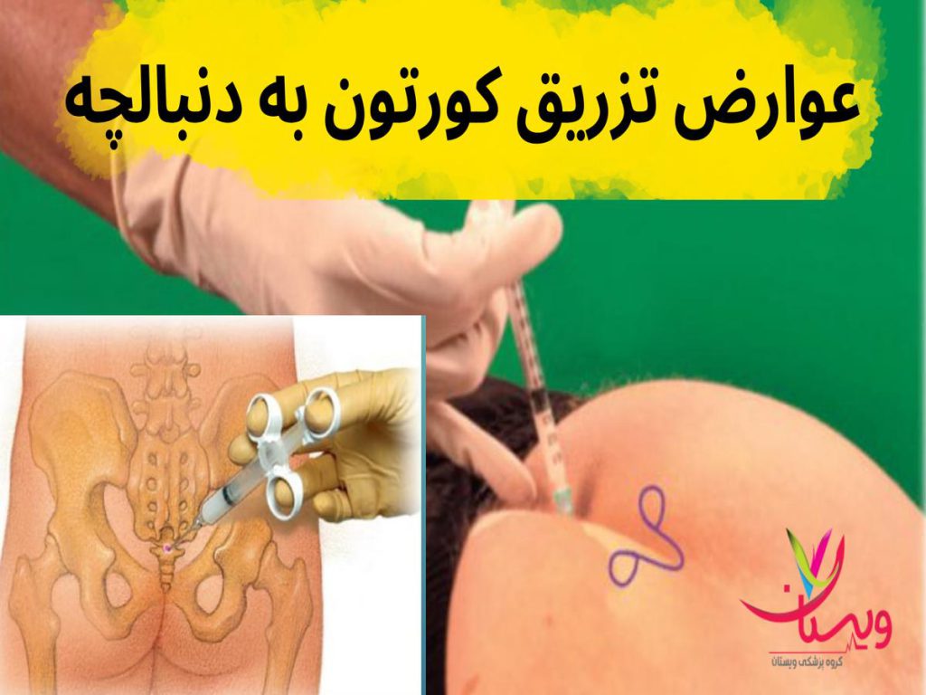 ناحیه دنبالچه عوارض تزریق کورتون به دنبالچه