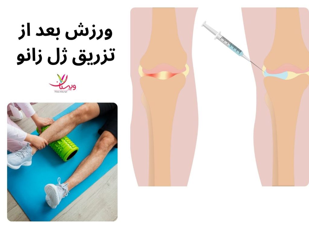 ورزش های بعد از تزریق ژل به زانو ورزش بعد از تزریق ژل زانو
