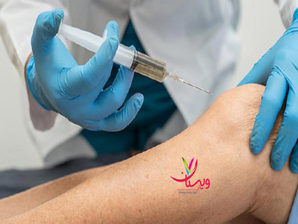 ژل زانو توصیههای ورزشی بعد از تزریق ژل زانو