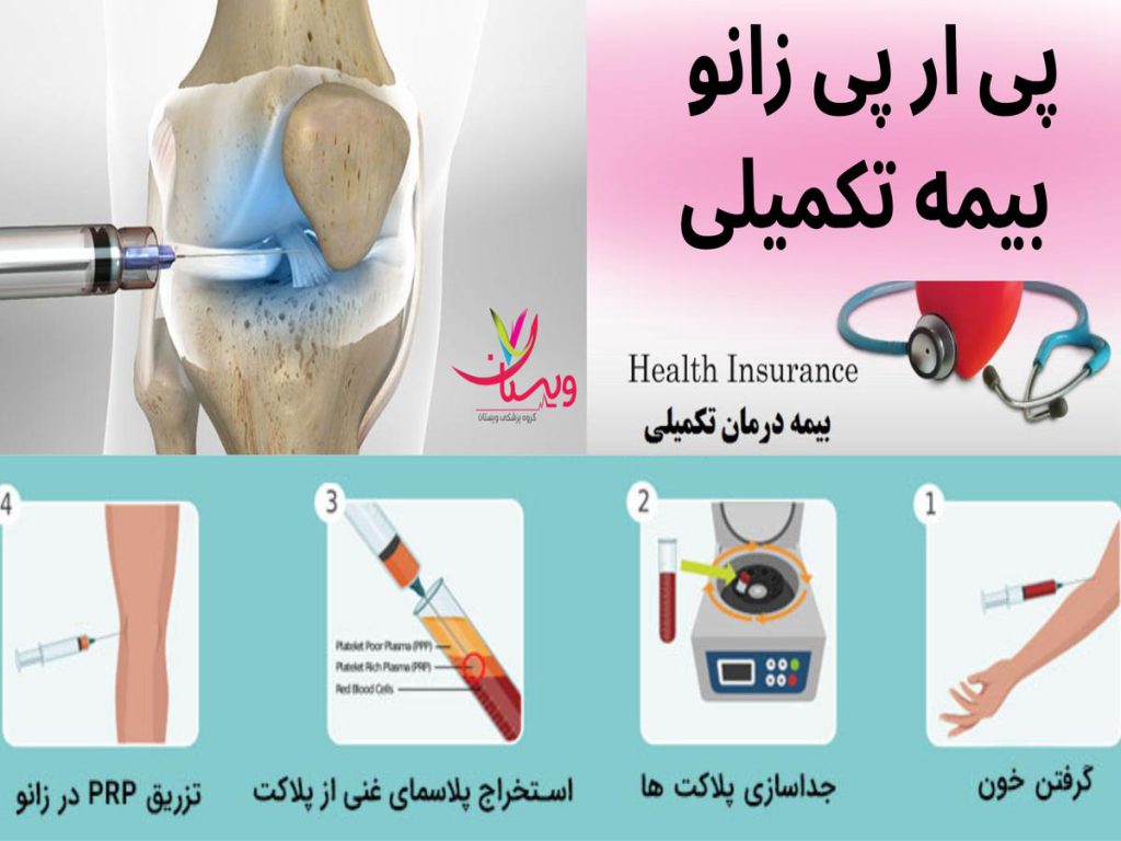 پی آر پی زانو پی ار پی زانو بیمه تکمیلی