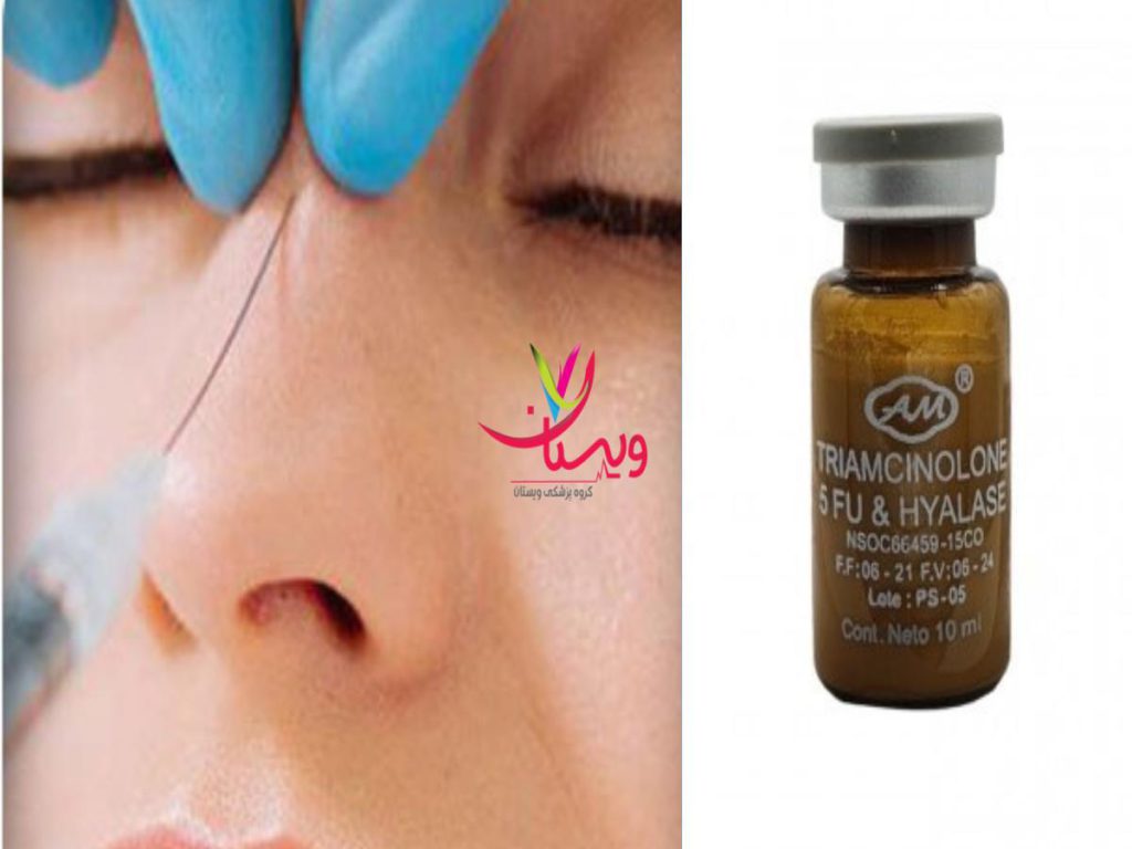 چربیهای اضافی کوکتل لاغری بینی