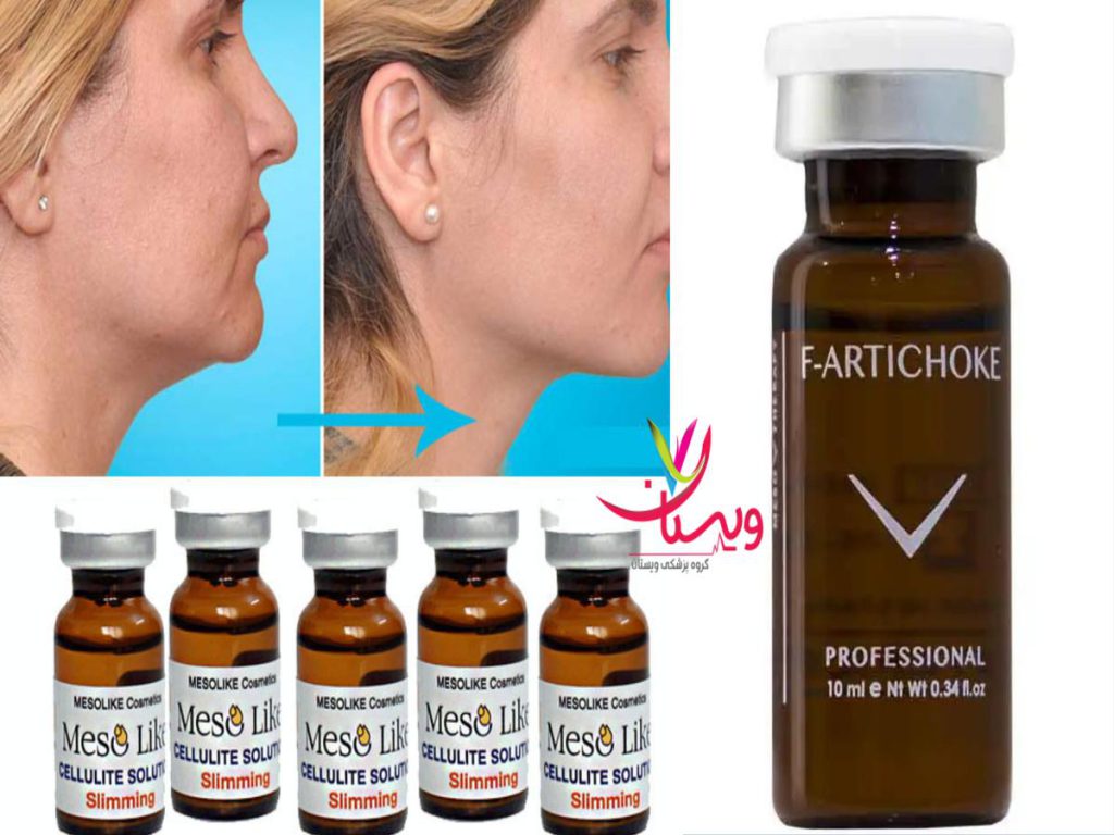 شکستن سلولهای چربی کوکتل لاغری غبغب