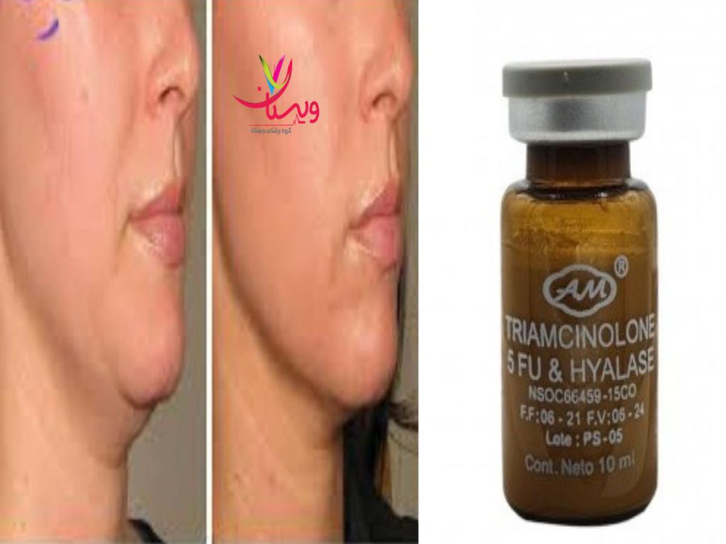 لاغری غبغب کوکتل لاغری غبغب