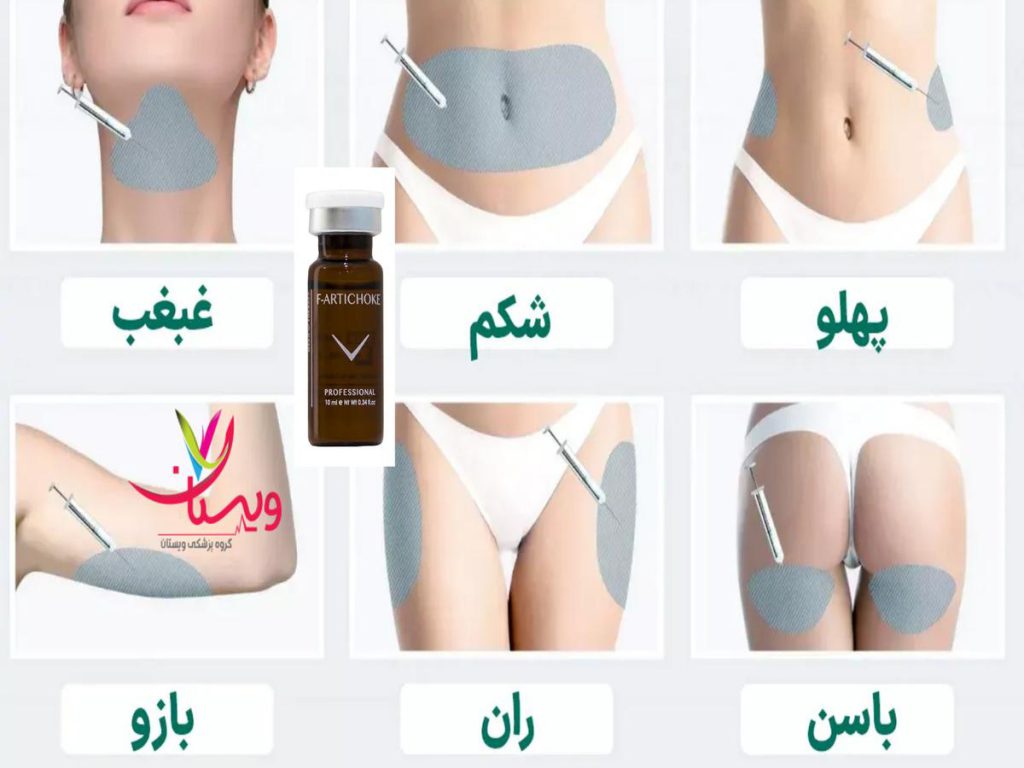 تزریق کوکتل لاغری کوکتل مزوتراپی لاغری چیست