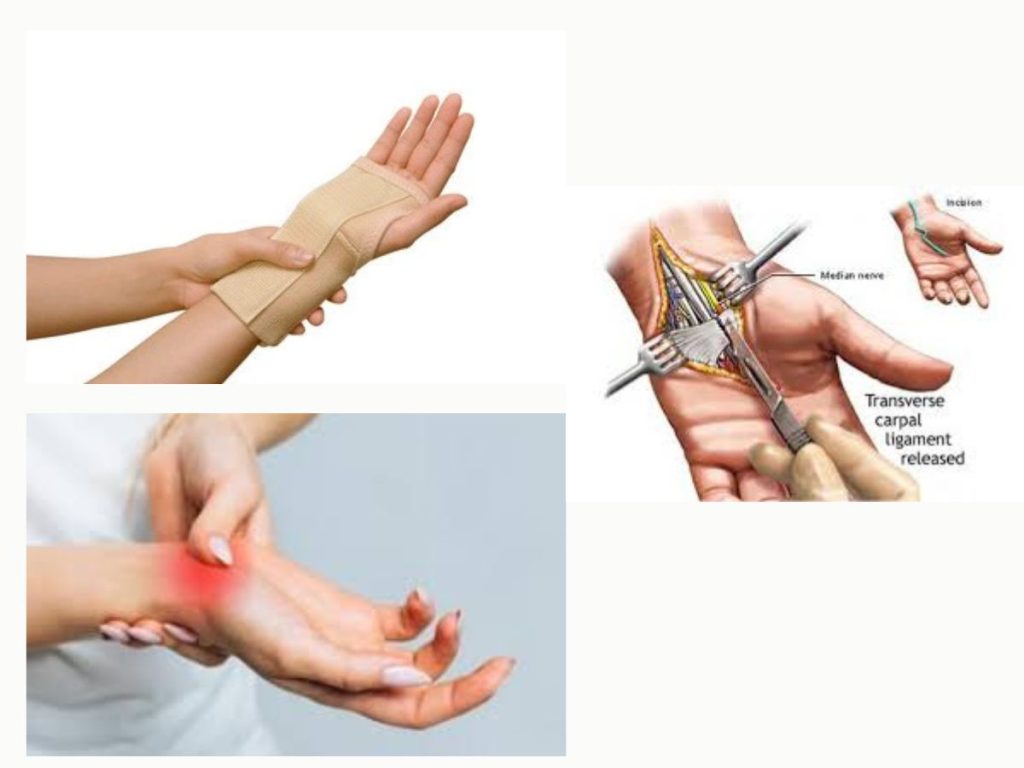 کاهش التهاب و تورم درمان تونل کارپال بدون جراحی