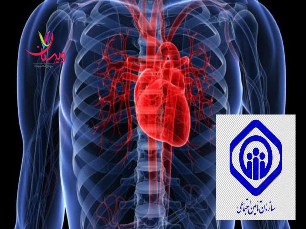 مرکز اکو قلب مراکز اکو قلب با بیمه تامین اجتماعی در غرب تهران