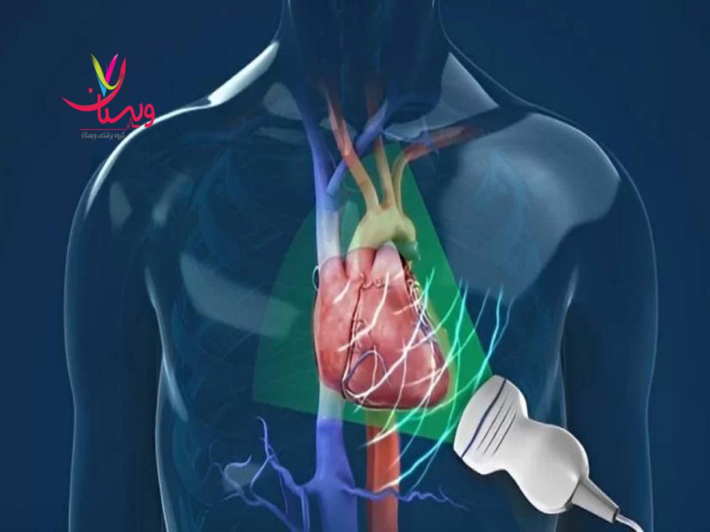 مراکز اکو قلب مراکز اکو قلب در تهران