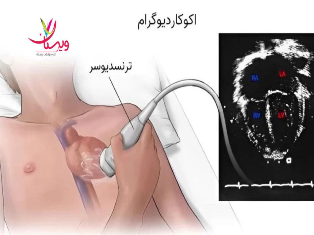 تست اکوکاردیوگرافی چگونه بهترین اکو قلب شبانه روزی در تهران را پیدا کنیم