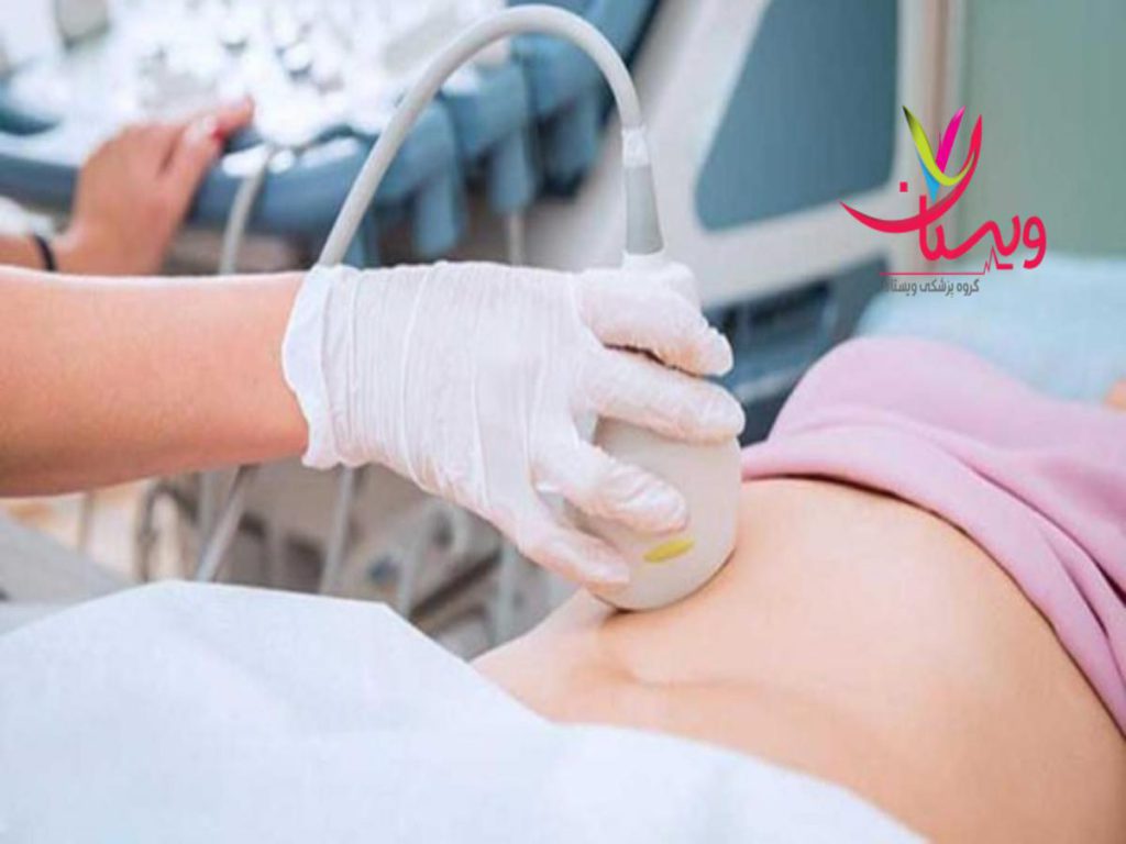 بیمه تکمیلی کدام سونوگرافی با بیمه تکمیلی قرارداد دارد