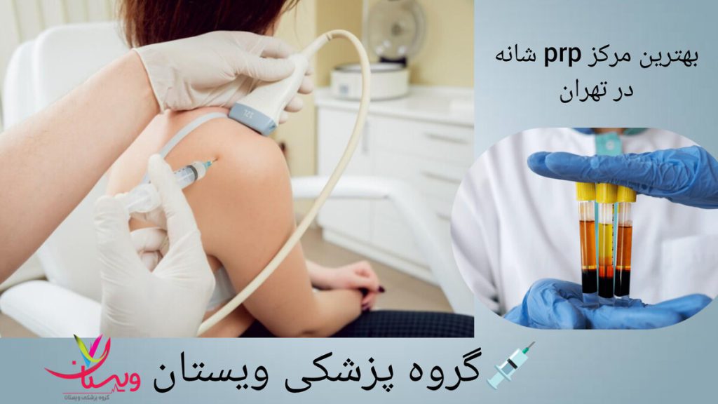 تزریق پی آر پی شانه برای درمان درد مفصلی
