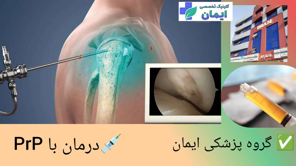 درمان موثر دردهای شانه با روش درمانی پی آر پی انجام پی آر پی شانه در گروه پزشکی ایمان