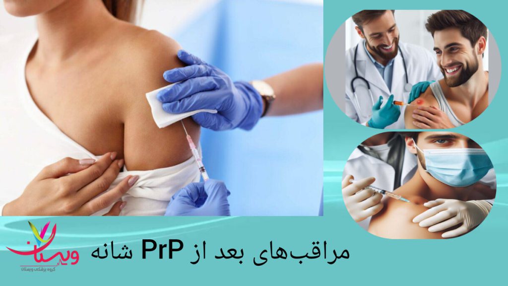 مراقبت های ویژه بعد از پی آر پی شانه انجام پی آر پی شانه برای بیمار توسط پزشک متخصص