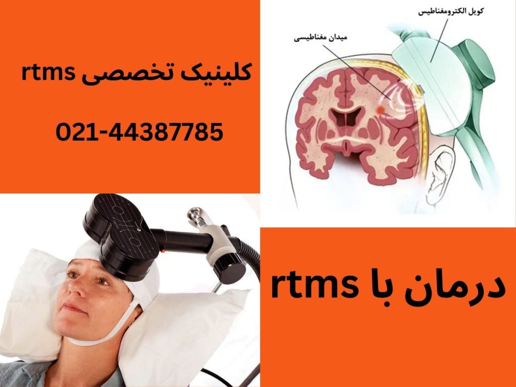 درمان با rtms