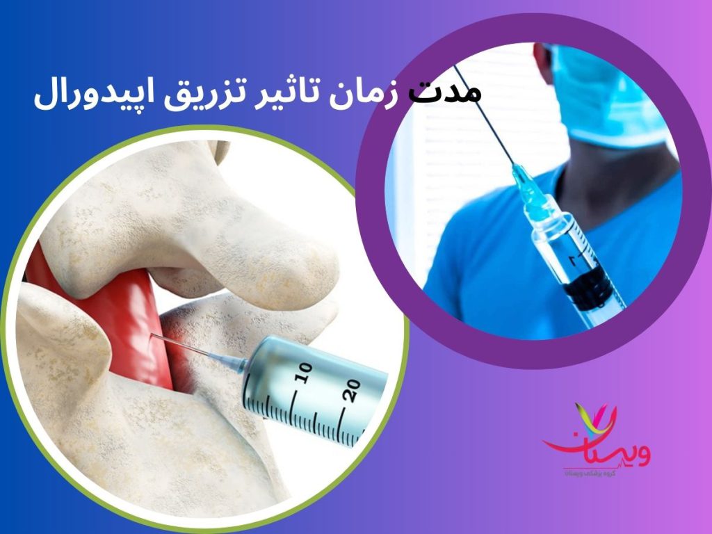 تزریق اپیدورال مدت زمان تاثیر تزریق اپیدورال