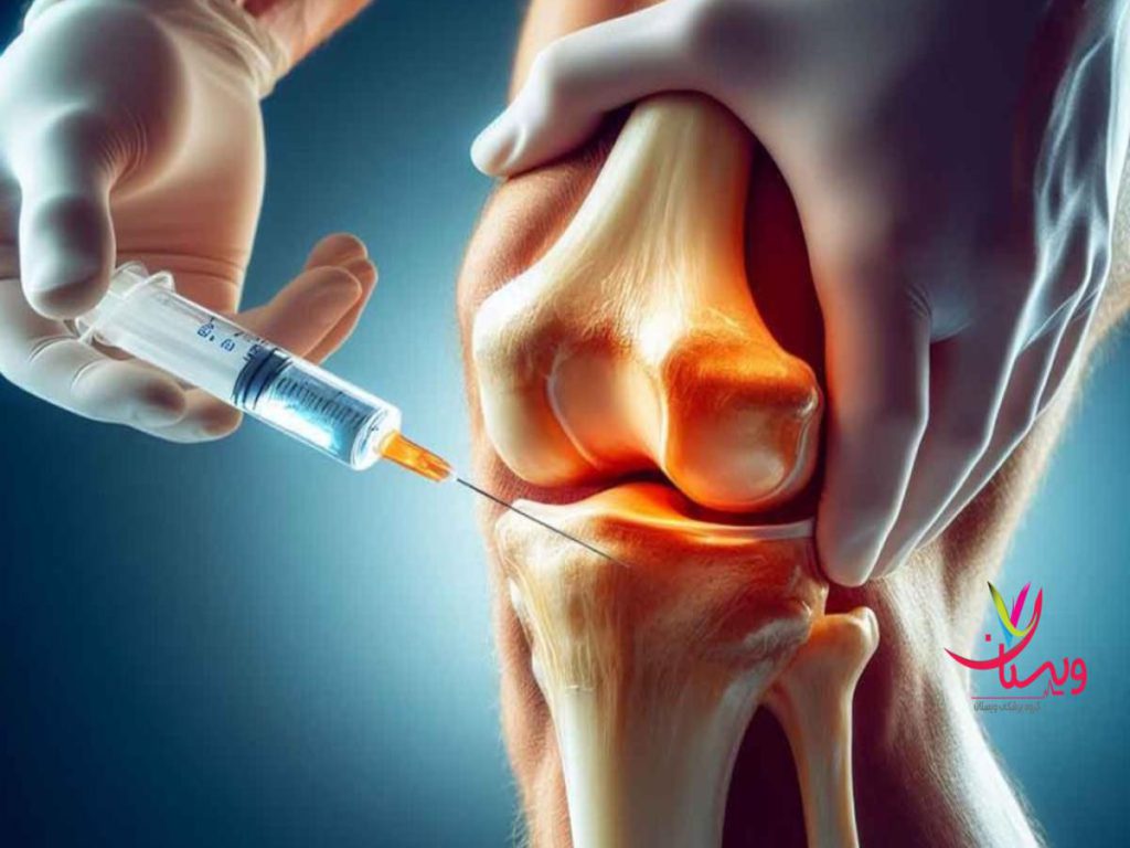 تزریق سلولهای بنیادی هزینه تزریق سلولهای بنیادی در زانو