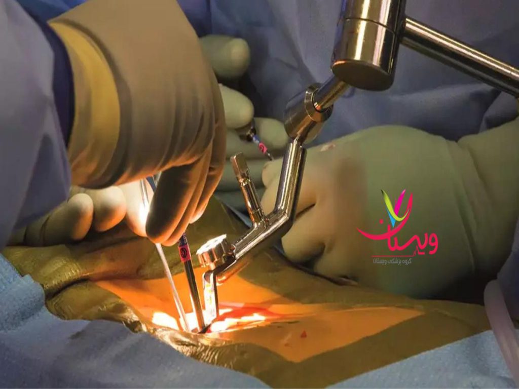 دیسک کمر هزینه جراحی دیسک کمر با لیزر در تهران